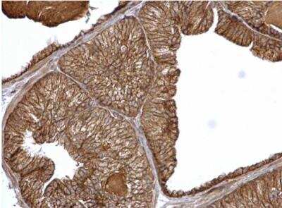 Immunohistochemistry-Paraffin: Catenin alpha 1 Antibody [NBP2-15723]