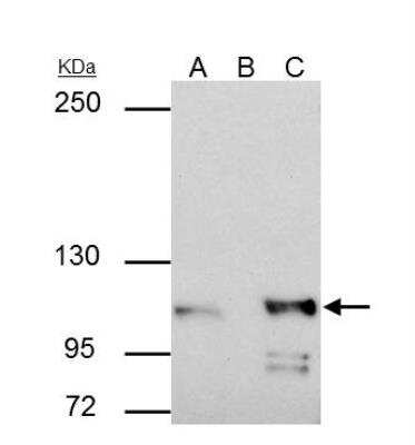 Immunoprecipitation: Catenin alpha 1 Antibody [NBP2-15723]