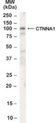 Western Blot: Catenin alpha 1 Antibody [NB100-2917]