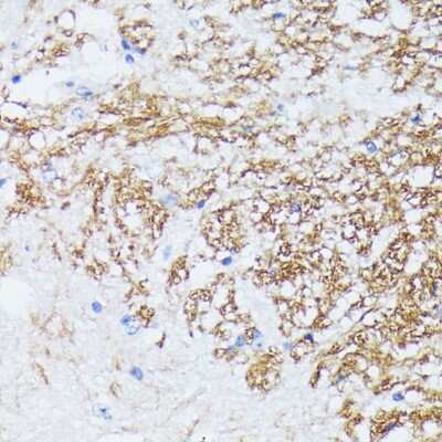 Immunohistochemistry-Paraffin: Catenin alpha 2 Antibody - Azide and BSA Free [NBP2-92753]