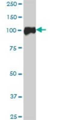 Western Blot: Catenin alpha 2 Antibody [H00001496-B01P]