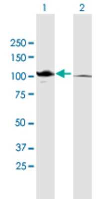 Western Blot: Catenin alpha 2 Antibody [H00001496-B01P]