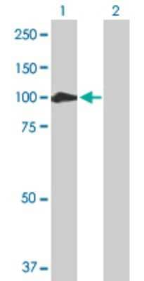 Western Blot: Catenin alpha 2 Antibody [H00001496-D01P]