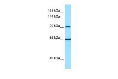 Western Blot: Catenin alpha 2 Antibody [NBP2-88777]