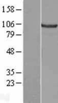 Western Blot: Catenin alpha 2 Overexpression Lysate [NBL1-09576]