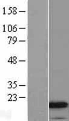 Western Blot: CAMP/LL37/FALL39/Cathelicidin Overexpression Lysate [NBL1-08670]