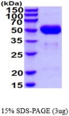 SDS-PAGE: Recombinant Mouse Cathepsin A/Lysosomal Carboxypeptidase A His Protein [NBP2-52322]