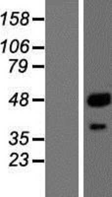 Western Blot: Cathepsin A/Lysosomal Carboxypeptidase A Overexpression Lysate [NBL1-09586]