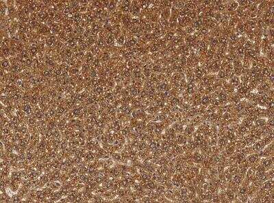 Immunohistochemistry-Paraffin: Cathepsin B Antibody (010) [NBP2-90402]