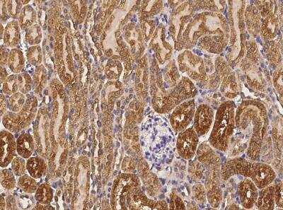 Immunohistochemistry-Paraffin: Cathepsin B Antibody (010) [NBP2-90402]