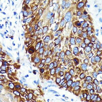 Immunohistochemistry-Paraffin: Cathepsin B Antibody (6I5D7) [NBP3-15614]