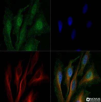 Immunocytochemistry/ Immunofluorescence: Cathepsin B Antibody - BSA Free [NBP1-19797]