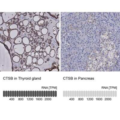 Immunocytochemistry/ Immunofluorescence: Cathepsin B Antibody [NBP3-16975]