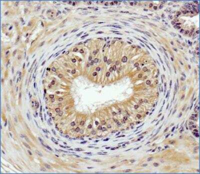 Immunohistochemistry-Paraffin: Cathepsin B Antibody - BSA Free [NBP1-19797]