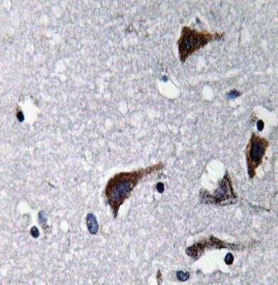 Immunohistochemistry-Paraffin: Cathepsin B Antibody - BSA Free [NBP1-19797]