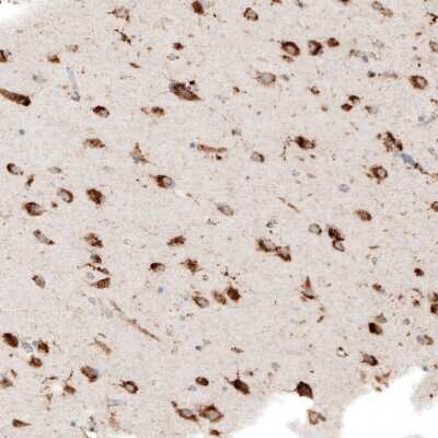 Immunohistochemistry-Paraffin: Cathepsin B Antibody [NBP1-86048]