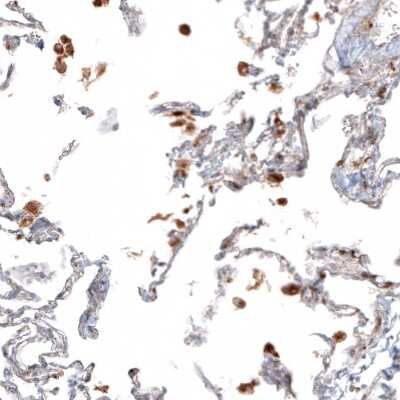 Immunohistochemistry-Paraffin: Cathepsin B Antibody [NBP1-86048]