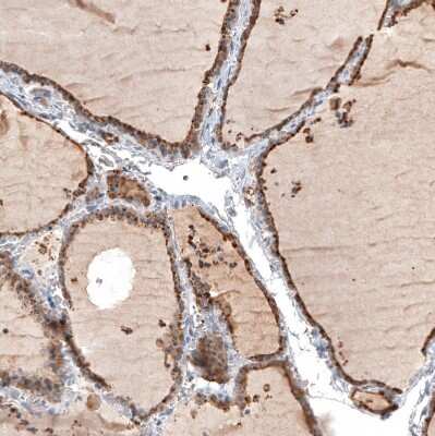 Immunohistochemistry-Paraffin: Cathepsin B Antibody [NBP1-86048]