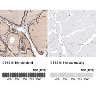 Immunohistochemistry-Paraffin: Cathepsin B Antibody [NBP1-86048]