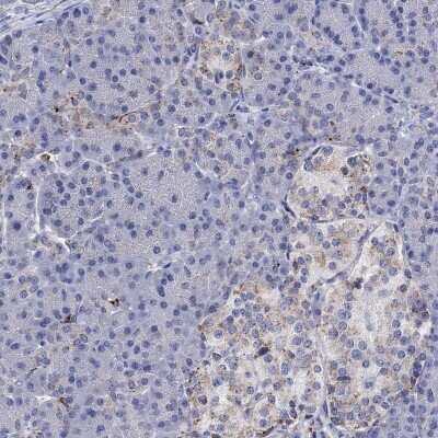 Immunohistochemistry-Paraffin: Cathepsin B Antibody [NBP3-16975]