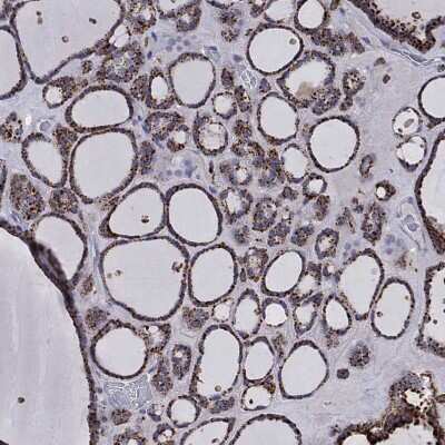 Immunohistochemistry-Paraffin: Cathepsin B Antibody [NBP3-16975]
