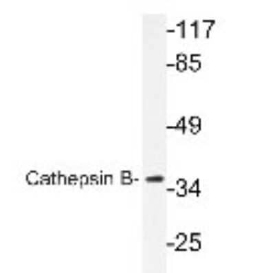 Western Blot: Cathepsin B AntibodyBSA Free [NBP1-19797]