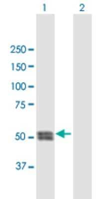 Western Blot: Cathepsin C/DPPI Antibody [H00001075-B01P]