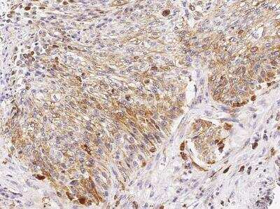 Immunohistochemistry-Paraffin: Cathepsin D Antibody (010) [NBP2-90119]