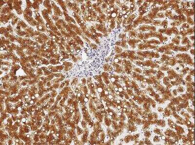 Immunohistochemistry-Paraffin: Cathepsin D Antibody (010) [NBP2-90119]