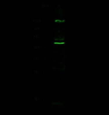 Western Blot: Cathepsin D Antibody (102) [NBP2-90432]