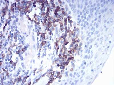 Immunohistochemistry: Cathepsin D Antibody (2H4H5) - BSA Free [NBP2-52451]