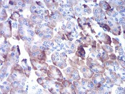 Immunohistochemistry-Paraffin: Cathepsin D Antibody (2H4H5) - BSA Free [NBP2-52451]