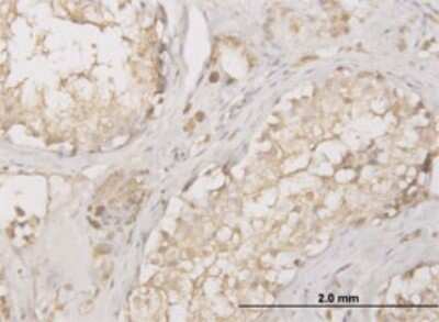 Immunohistochemistry-Paraffin: Cathepsin D Antibody (3F12-1B9) [H00001509-M01]