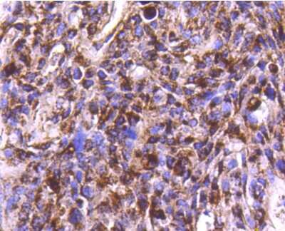 Immunohistochemistry-Paraffin: Cathepsin D Antibody (SU0360) [NBP2-67477]