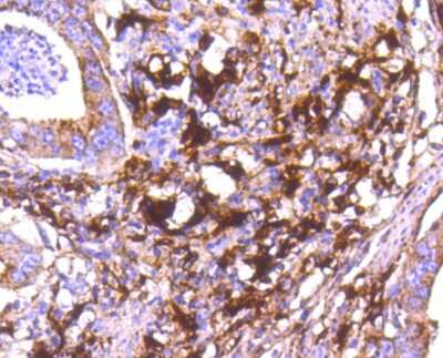 Immunohistochemistry-Paraffin: Cathepsin D Antibody (SU0360) [NBP2-67477]