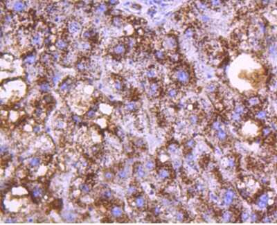 Immunohistochemistry-Paraffin: Cathepsin D Antibody (SU0360) [NBP2-67477]