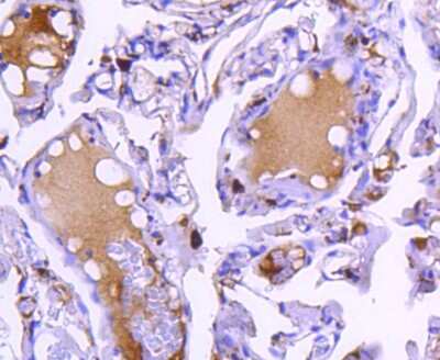 Immunohistochemistry-Paraffin: Cathepsin D Antibody (SU0360) [NBP2-67477]