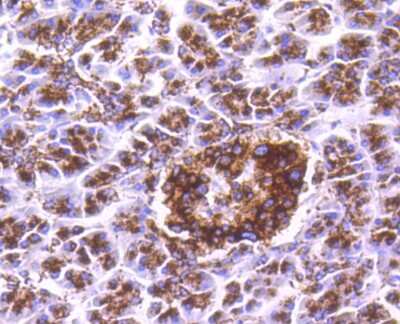 Immunohistochemistry-Paraffin: Cathepsin D Antibody (SU0360) [NBP2-67477]