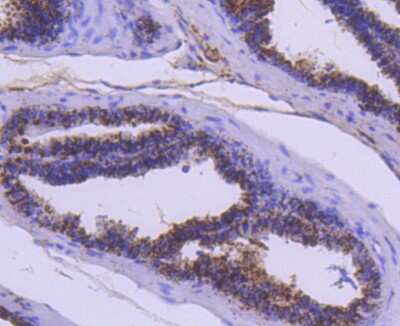 Immunohistochemistry-Paraffin: Cathepsin D Antibody (SU0360) [NBP2-67477]