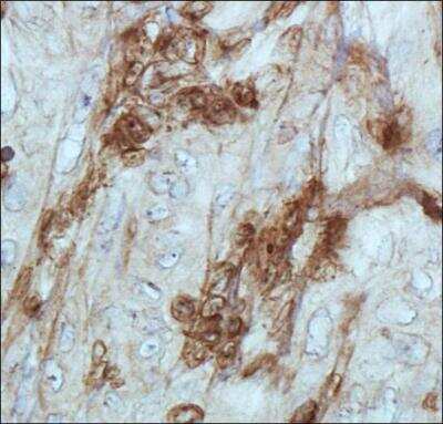 Immunohistochemistry: Cathepsin E Antibody [NB400-152]