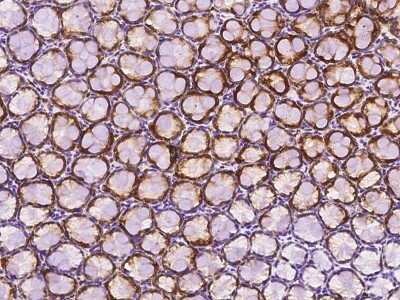 Immunohistochemistry-Paraffin: Cathepsin E Antibody [NBP2-98304]