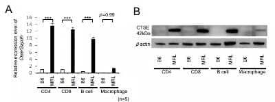 Western Blot: Cathepsin E Antibody [NB400-152]