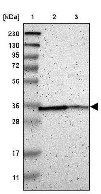 Western Blot: Cathepsin E Antibody [NBP2-33868]