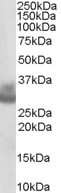 Western Blot: Cathepsin F Antibody [NB100-1784]