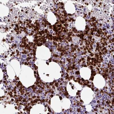 Immunohistochemistry-Paraffin: Cathepsin G Antibody [NBP2-33498]