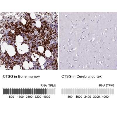 Immunohistochemistry-Paraffin: Cathepsin G Antibody [NBP2-33498]