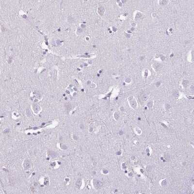 Immunohistochemistry-Paraffin: Cathepsin G Antibody [NBP2-33498]
