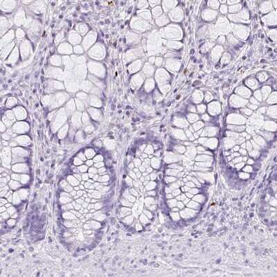 Immunohistochemistry-Paraffin: Cathepsin G Antibody [NBP2-33498]