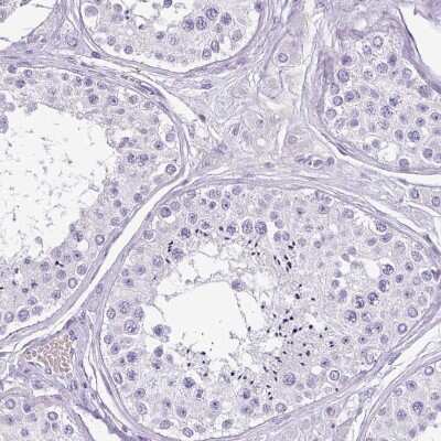 Immunohistochemistry-Paraffin: Cathepsin G Antibody [NBP2-33498]