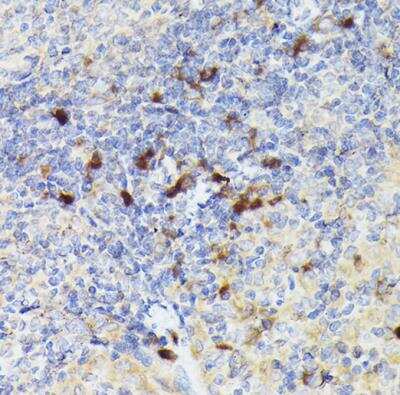 Immunohistochemistry-Paraffin: Cathepsin G Antibody - Azide and BSA Free [NBP2-92789]